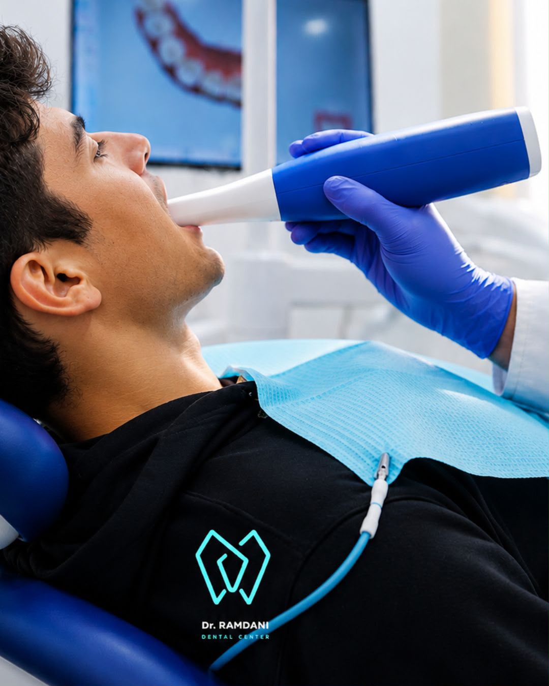 Scanner intra-oral